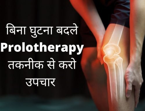 नहीं पडेगी घुटने बदलने की जरुरत, दर्द दूर करने में रामबाण प्रोलोथेरेपी उपचार