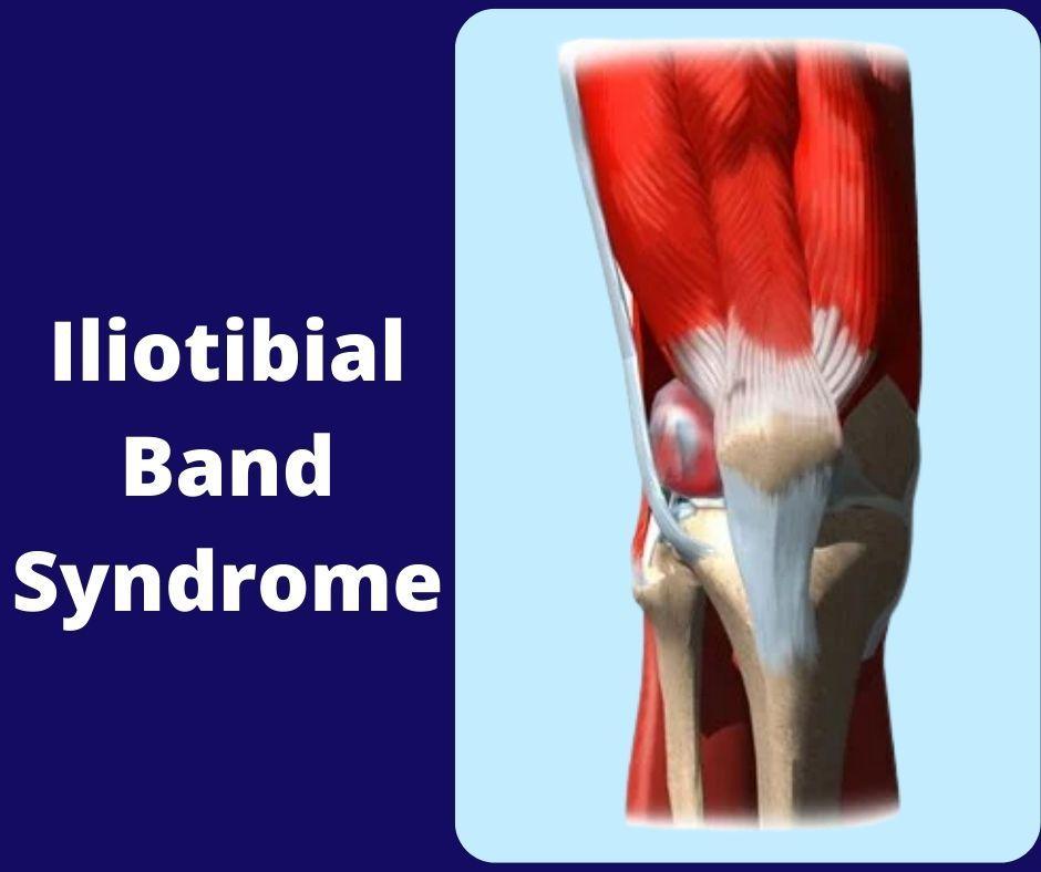 Iliotibial-band-syndrome- treatment-in-Pune