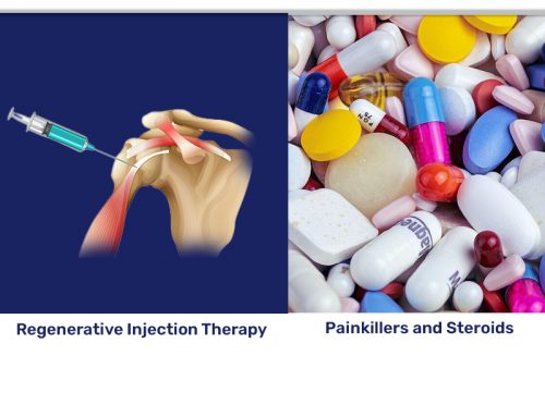 Prolotherapy vs Other Pain Treatments. Which is right for you?