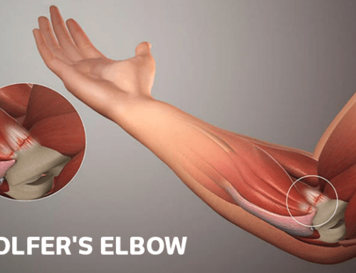 Things you didn’t know about Golfer’s Elbow?