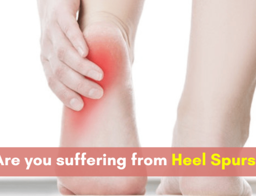 Are you Suffering from Heel Spurs?