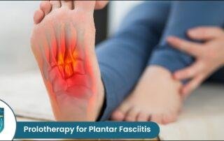 Prolotherapy for Plantar Fasciitis
