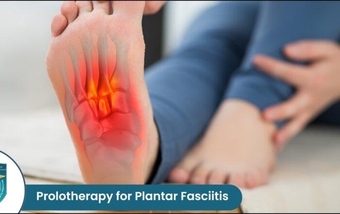 Prolotherapy for Plantar Fasciitis
