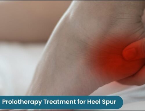 Advanced Prolotherapy Treatment for Heel Spur