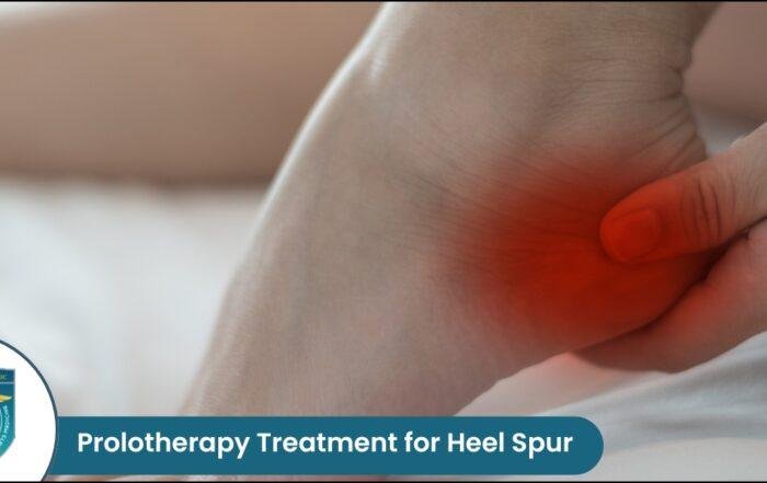 Prolotherapy for Heel Spur