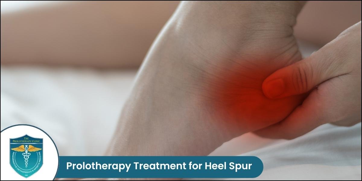 Prolotherapy for Heel Spur