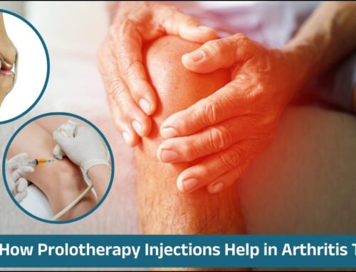How Prolotherapy Injections Help in Arthritis Treatment