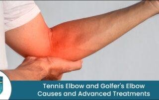 Tennis Elbow and Golfer's Elbow Treatment