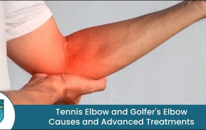 Tennis Elbow and Golfer's Elbow Treatment