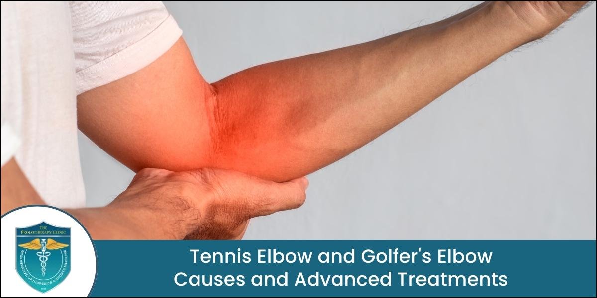 Tennis Elbow and Golfer's Elbow Treatment