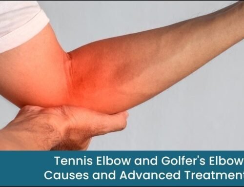 Tennis Elbow and Golfer’s Elbow: Causes and Advanced Treatments
